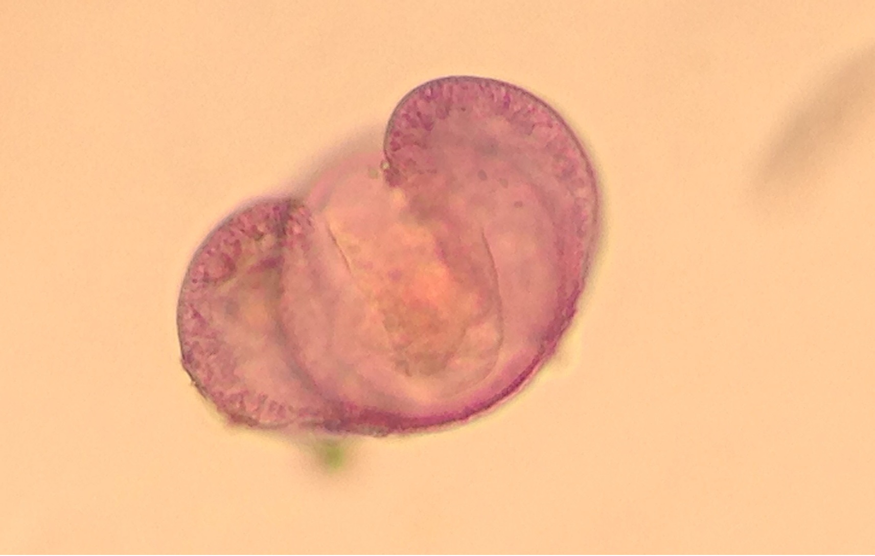 Pollen de pin (Pinus) (x40)